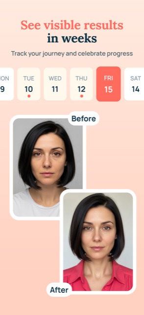 Before and after progress tracking in Elastica